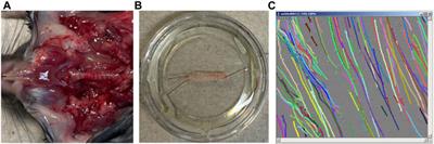 A 20:1 synergetic mixture of cafedrine/theodrenaline accelerates particle transport velocity in murine tracheal epithelium via IP3 receptor-associated calcium release